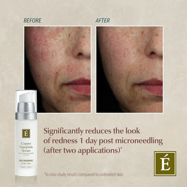 Eminence: Copper Tripeptide Serum