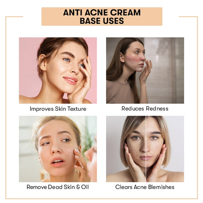 Anti Acne Cream Base Uses